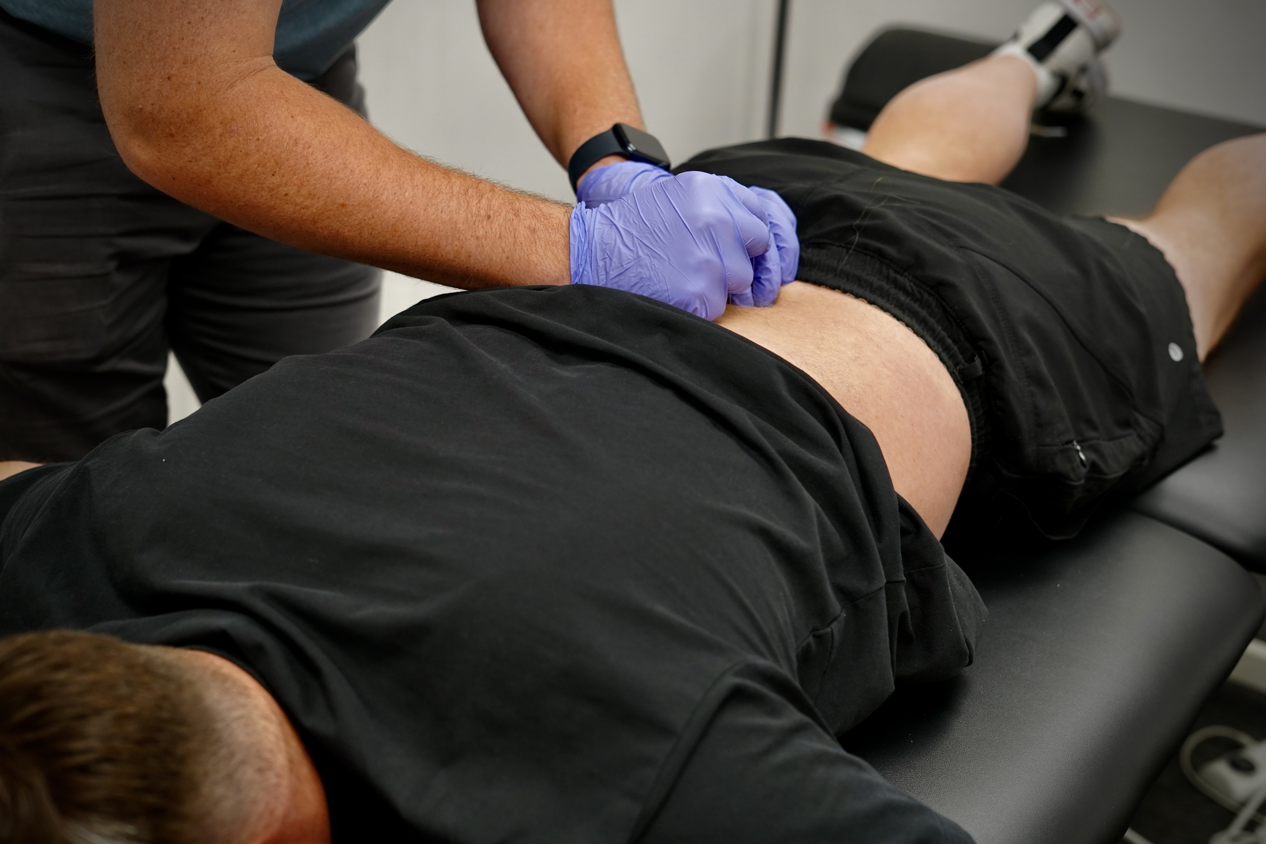 Dry Needling to the Lumbar Spine by a Licensed and Certified DPT (Doctor of Physical Therapy)